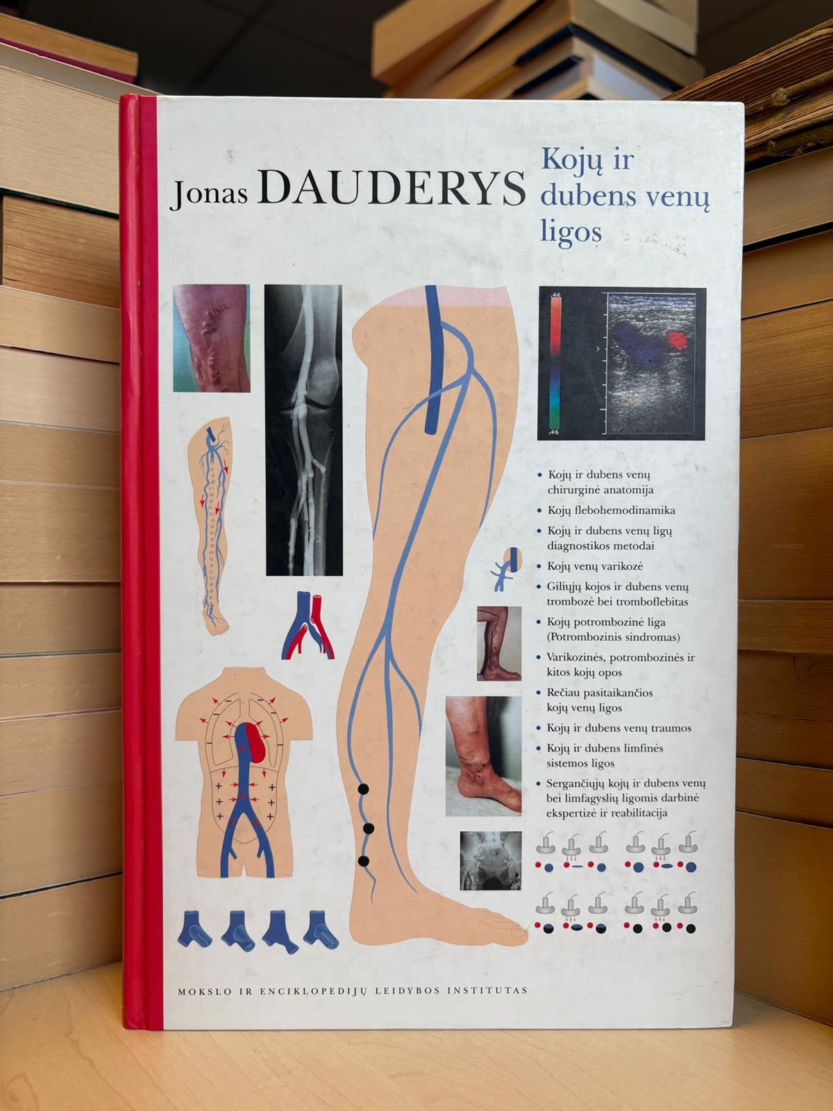 Jonas Dauderys - ,,Kojų ir dubens venų ligos"